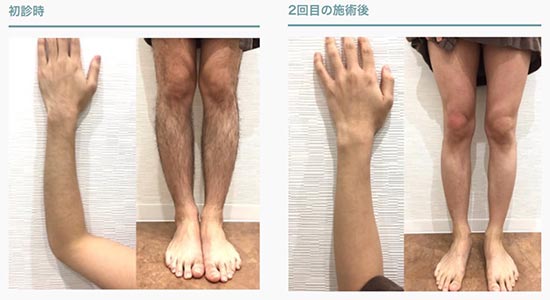 33_medical_hair_removal_mens_clinic02_1